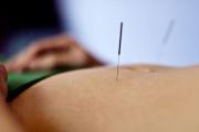 Precios Tratamientos de Medicina Tradicional China - Acupuntura, Masajes y más