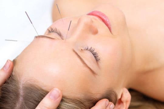 Acupuntura cosmética