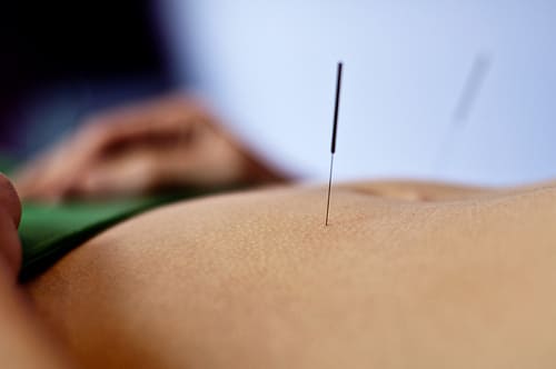 Precios & Bonos 1 precio acupuntura