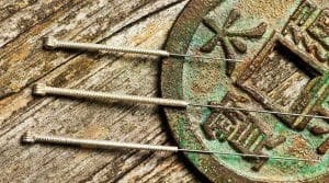 acupuncture français valencia