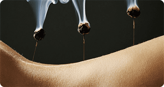 acupuntura con moxa