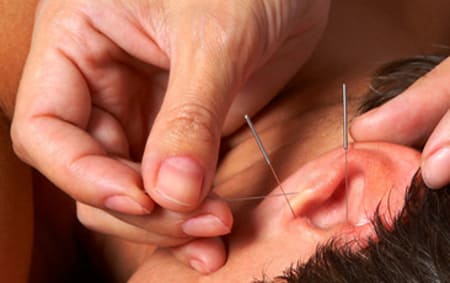 auriculoterapia valencia