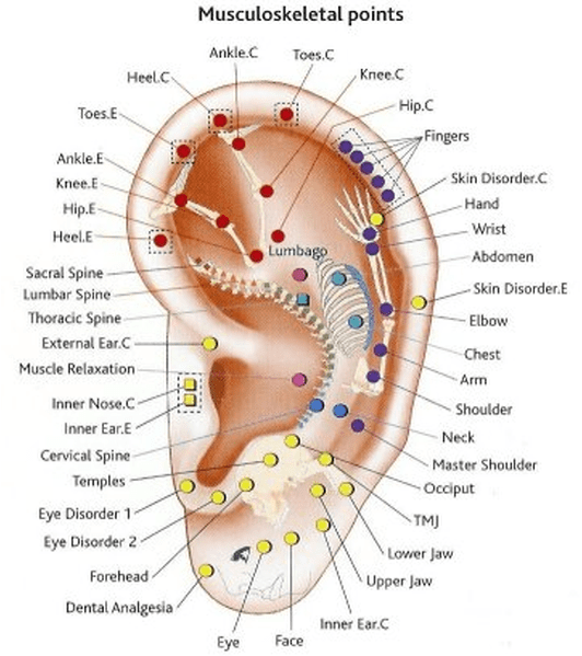 puntos muscoesqueleticos auriculoterapia