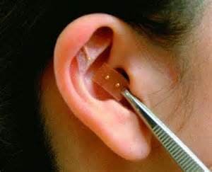 semillas auriculoterapia