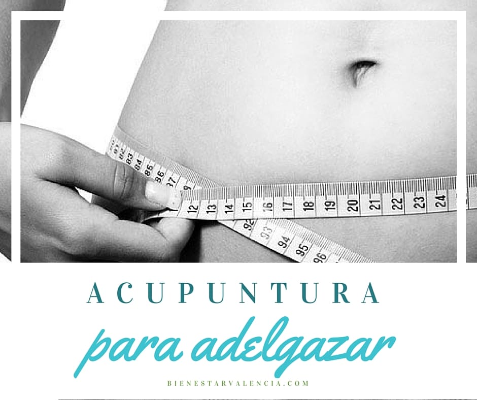 acupuntura para adelgazar