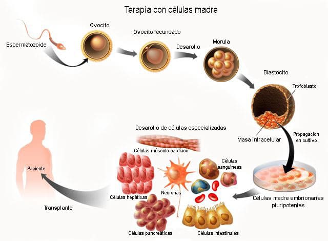 terapia con células madre