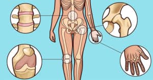 Fotos de artritis de varios tipos de articulaciones.