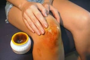 tratamiento de la artritis de las articulaciones, remedios caseros