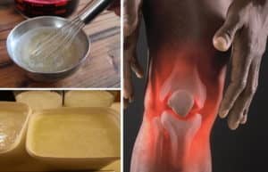 remedios caseros para la artritis de las articulaciones