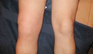 síntomas de la enfermedad descripción completa de la enfermedad