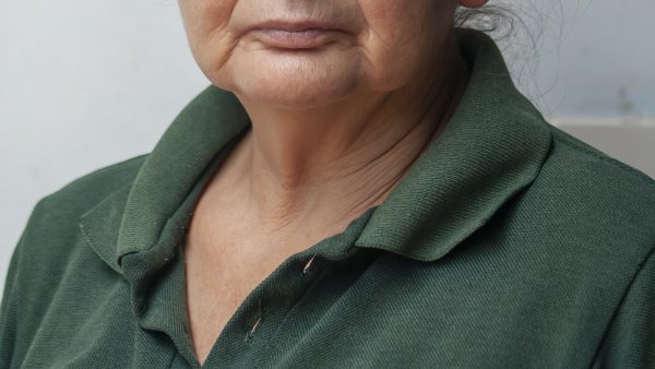 1. ¿Qué es la Zaragatona y cómo puede beneficiar tu cabello?